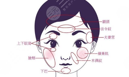 玻尿酸填充脸部可以维持多久?
