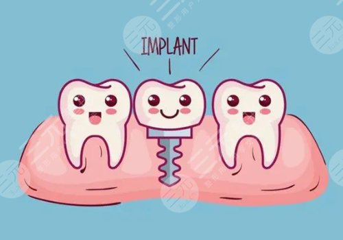 种植牙的五大危害盘点！损伤感染、牙龈炎等比较常见~