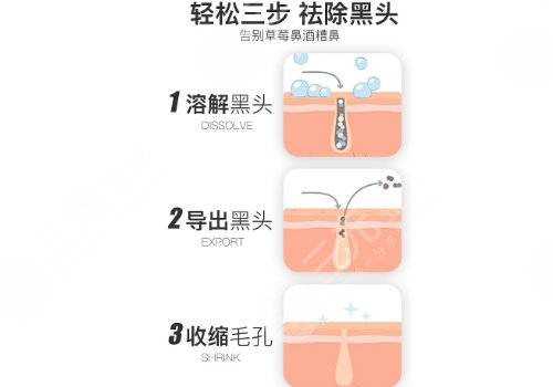 黑头导出液真的有用吗?