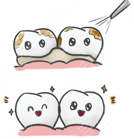 洗牙牙齿能变白吗?