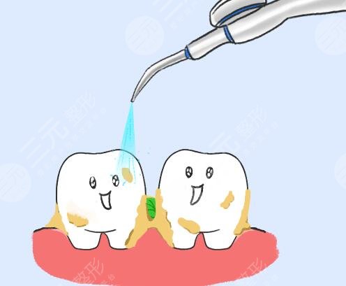 洗一次牙能维持多久?