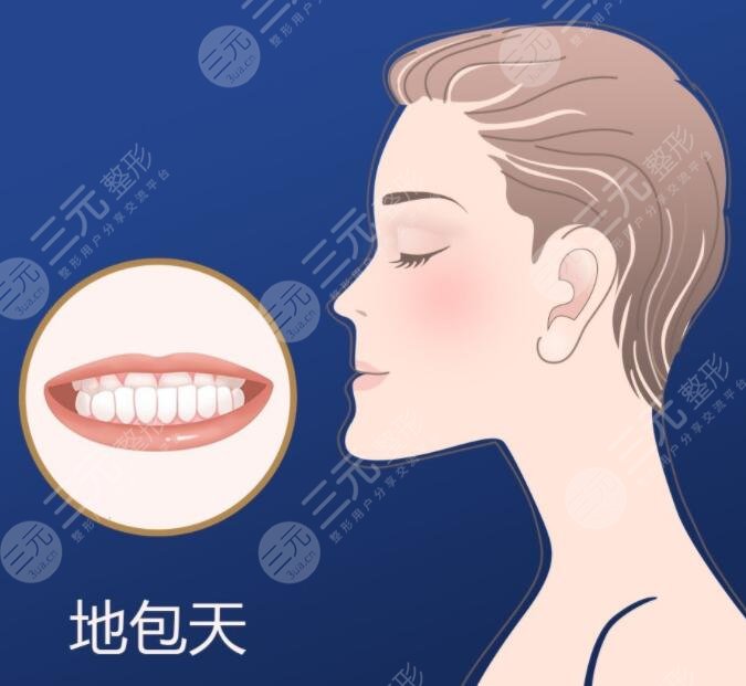 地包天矫正结果好吗?