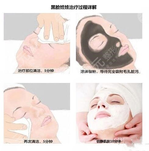 影响黑脸娃娃价格的因素