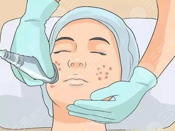 痤疮生长的原因是什么呢?