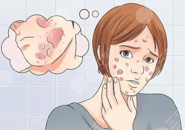 缓解痤疮的注意事项