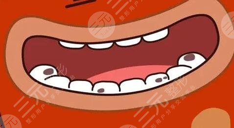 龋齿如何缓解和预防?介绍3种对付龋齿强有力的缓解方案,看看你适合哪种?