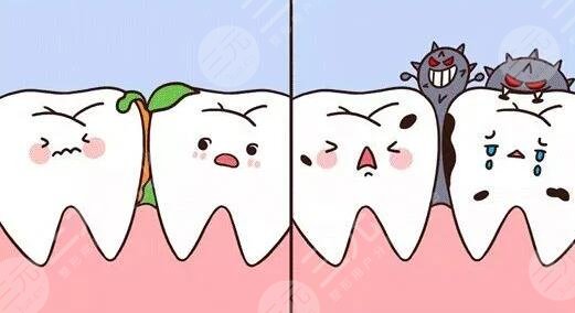 龋齿如何缓解?