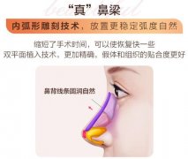 怎么让鼻梁挺起来？3种医美方案，带你打造俏挺美鼻！