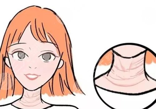 2,去颈纹的好处