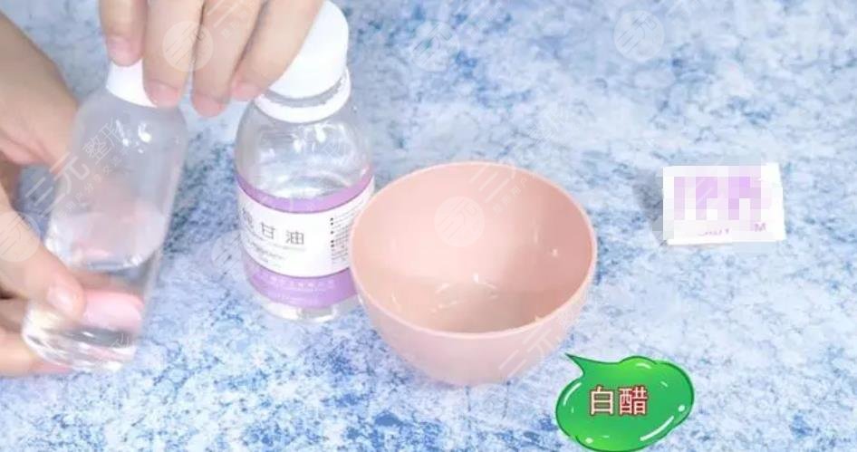 怎么去掉脸上斑?