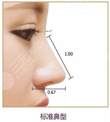 自体软骨隆鼻效果怎?么样?