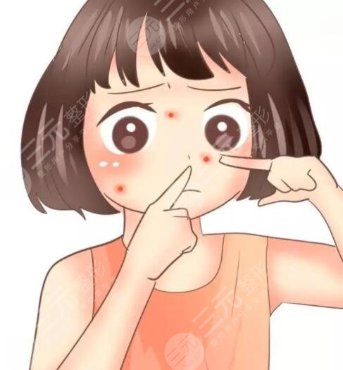 激光手术修复痘印痘坑能够维持多久?