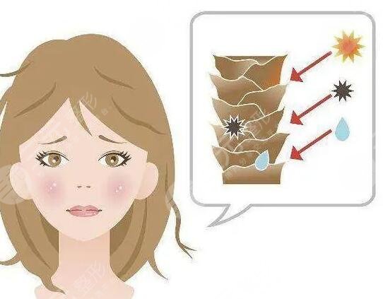 彩光嫩肤副作用大吗?