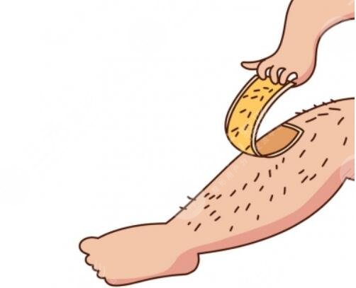 激光脱毛的原理是什么呢?