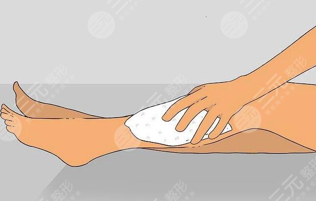 小腿激光脱毛的价格多少钱?