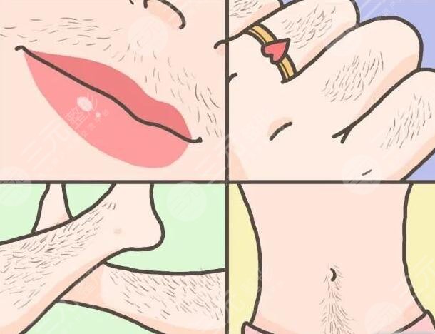 小腿激光脱毛的注意事项