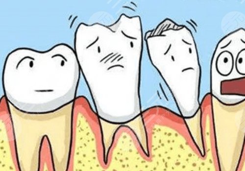 牙齿松动有什么办法恢复?