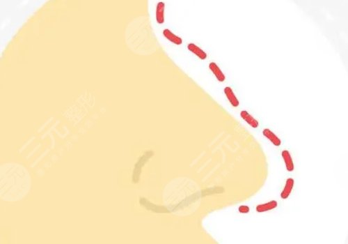 徐学东医生擅长项目