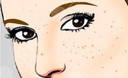 蜂蜜祛斑的小窍门是什么？具体制作操作大全记录，长期坚持有！