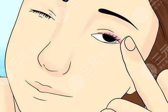 眼部脂肪粒如何去除小妙招，这4种强有力的手段让你摆脱“小米粒”痛苦！
