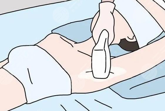 激光脱毛多长时?间一次?