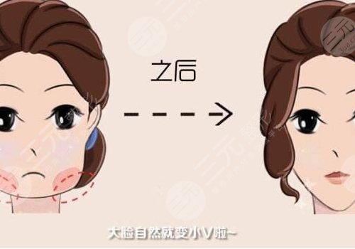 上海美联臣曹栋弼磨骨怎么样