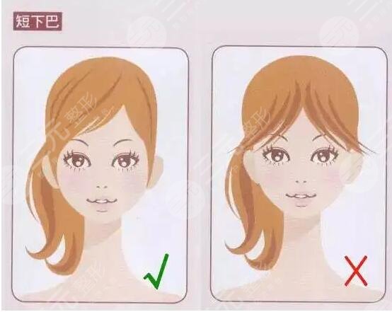 做了下巴整形手术之后需要注意什么?