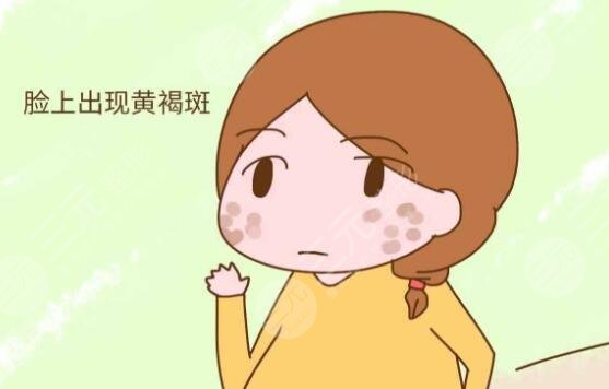 激光缓解黄褐斑注意什么?