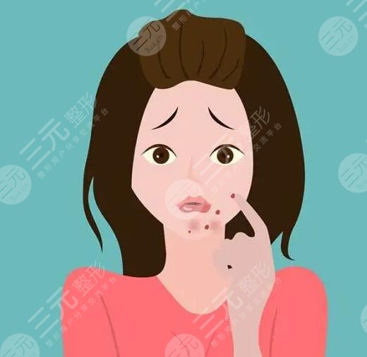 　　如何快速去青春痘?对于青春期的男生和女生们来讲，大多数人都难逃青春痘的困扰，青春痘严重的时候会影响到一个人的颜值，所以青春期的男生和女生们大多都在战“痘”，可是在缓解痘痘的时候也需要选对方法，不要盲目的去除痘痘，以免对皮肤造成伤害，下面做一个护肤达人，就来带大家深入的认识一下，如何快速去除青春痘?被青春痘困扰的男生女生可以详细来了解一下。  　　1、如何快速去青春痘?  　　日常生活中快速去除青春痘的方式，常见的有药物缓解、激光缓解以及红蓝光照射等，可以根据自己的皮肤状态选择适合自己的去除青春痘方式。  　　(1)药物缓解  　　皮肤上的青春痘可以在专业医生指导下，使用红霉素软膏或者阿达帕林凝胶进行缓解，这些药膏能够快速消除青春痘。但是需要在专业医生指导下规范用药，不要盲目的使用，以免对皮肤造成伤害。  　　(2)激光缓解  　　激光缓解青春痘是医疗美容界的一种新型祛痘方式，激光缓解青春痘的原理，主要通过激光仪器所发出的高能热量穿透皮肤表皮层，直接作用在皮肤基底层，这种热量能够促进皮肤深层细胞组织生长，从而可以让皮肤上的青春痘逐渐修复，可以让皮肤恢复到光滑平整的目的。  　　(3)红蓝光照射  　　红蓝光照射缓解青春痘，主要采用专业仪器发出的红光热效应和蓝光热效应对皮肤进行交替照射，缓解皮肤上青春痘的同时还可以消除皮肤上的炎症，是缓解青春痘的一种不错的方式。  　　2、青春痘是怎样形成的?  　　青春痘大多是因为毛囊皮脂腺炎症性病变导致的，因为身体的内分泌失调，导致雄激素水平偏高，从而诱发皮脂腺分泌增多，同时毛孔角化排出也不够顺畅，从而就形成了脂肪酸，继发细菌感染的时候就会形成青春痘。另外在日常生活中长时间喝酒，或者总是吃一些高脂肪饮食，或者是日常生活中总是长时间熬夜也会导致青春痘生长。需要注意的是青春痘并不一定是发生在青春期的，通常现在大多数人因为生活节奏加快，成年人长青春痘也不少见，并且比青春期长的青春痘要比较顽固和复杂。  　　3、怎样防止青春痘?  　　想要防止青春痘，在日常生活中要养成良好的饮食习惯和规律作息，平时饮食尽量少吃吃热量比较高和脂肪含量比较高的食物，饮食可以以清淡食物为主，可以适当的多吃一些新鲜的蔬菜和水果，多喝一些温开水，补充身体所需要的维生素和微量元素，防止身体便秘。另外还要适当的加强体育运动，让身体适当的多出一些汗。除此之外要养成良好的规律作息，每天保持充足的睡眠，不要长时间熬夜，避免有太大的精神压力和过于抑郁的情绪。