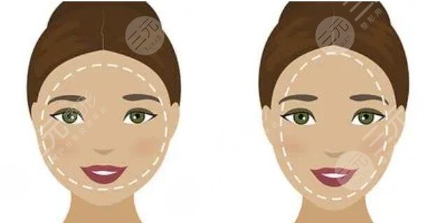 鹅蛋脸