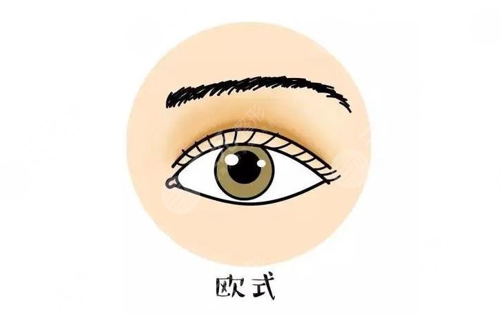 欧式割双眼皮多?少钱?