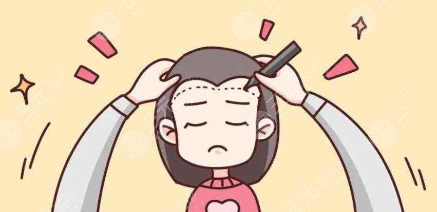 植发之后需要注意什么?