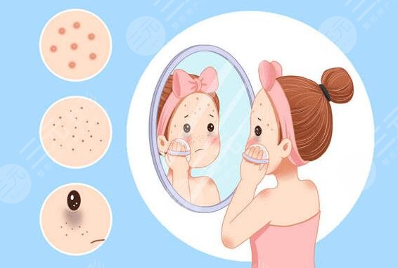 斑点是怎样形成的?