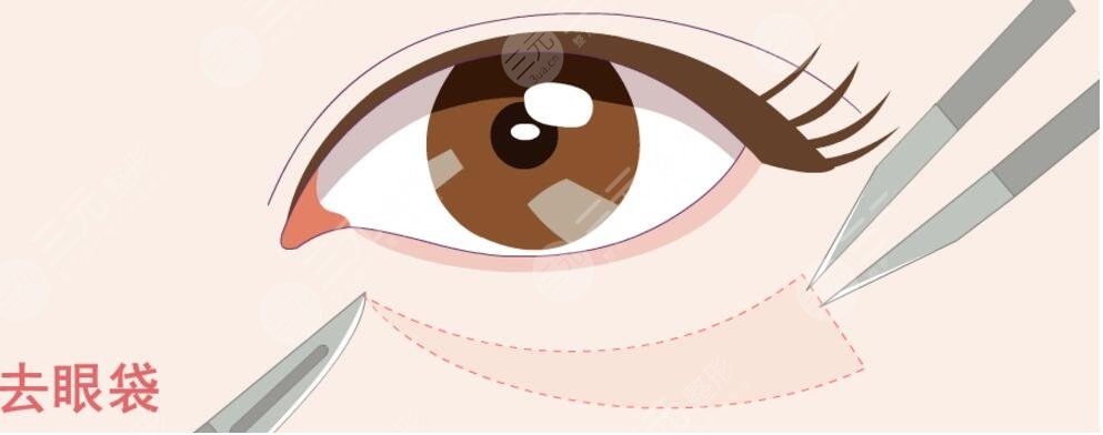 眼袋生长的原因是什么呢?