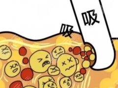 吸脂减肥的危害有哪些？术前科普知识，拒绝谣言，正确认识ta！