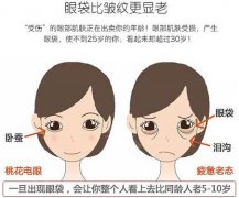 不用手术去眼袋是真的吗？4种思路对比分析，“养眼”指南！
