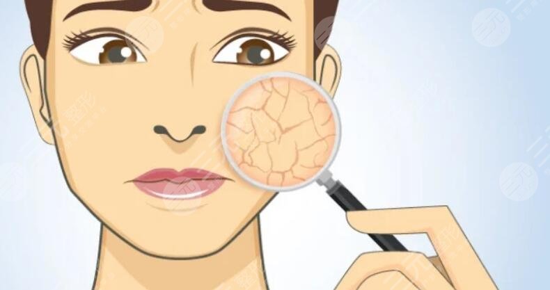 面部皮肤干燥粗糙