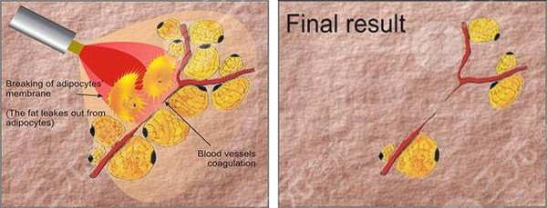 全封闭减肥训练营?价格是多少?