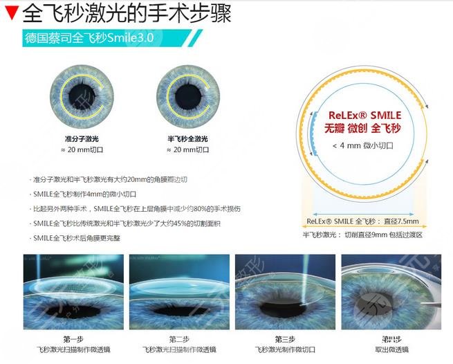眼睛近视如何?缓解好?