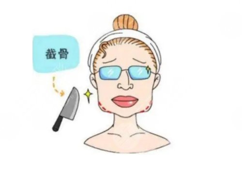 罗金超做下颌角怎么样?