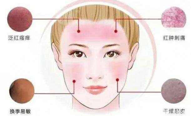 脸颊红血丝怎么办，如何消除？3个方案分享，美丽不留暇！