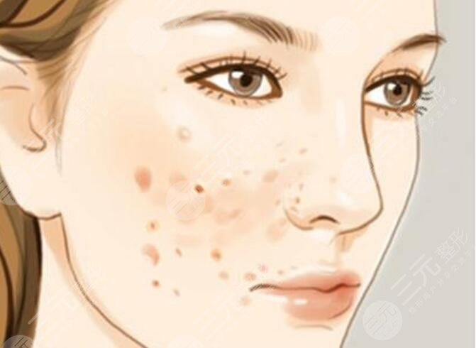 美白祛斑小窍门有哪些？看看哪些方案祛斑效果且操作简易！轻松易上手！