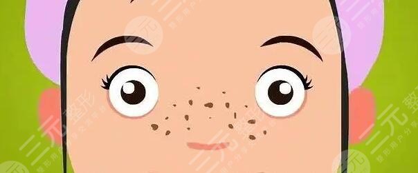 美白祛斑小窍门有哪些?