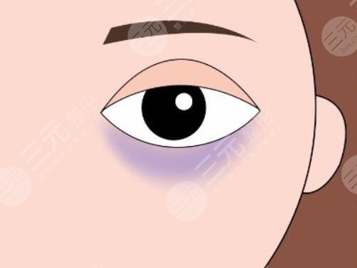 有黑眼圈是怎么回事？先天遗传、后天因素导致的原因分析，该怎么有效避免？