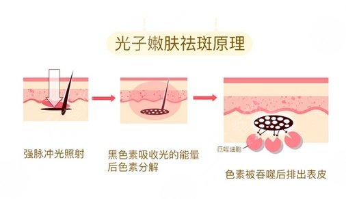 陆军总医院皮肤激光美容中心