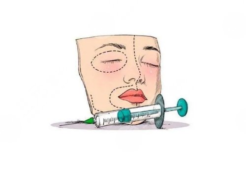 宝尼达填充眉骨会下移吗?