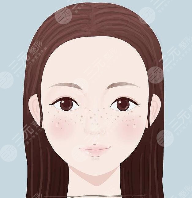 脸上长斑怎么去除有效?