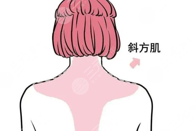 背部吸脂