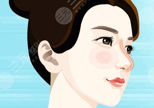 宝尼达隆鼻会变宽吗?