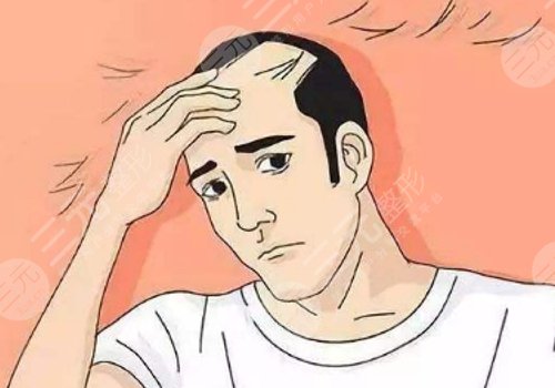 纹发和植发哪个效果好?
